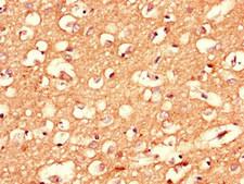 CPLX1 / Complexin 1 Antibody - Immunohistochemistry of paraffin-embedded human brain tissue using CPLX1 Antibody at dilution of 1:100