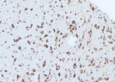 CPLX1 / Complexin 1 Antibody - 1:100 staining mouse brain tissue by IHC-P. The sample was formaldehyde fixed and a heat mediated antigen retrieval step in citrate buffer was performed. The sample was then blocked and incubated with the antibody for 1.5 hours at 22°C. An HRP conjugated goat anti-rabbit antibody was used as the secondary.