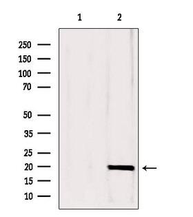 CPLX1 / Complexin 1 Antibody - Western blot analysis of extracts of mouse brain tissue using CPLX1 antibody. Lane 1 was treated with the blocking peptide.