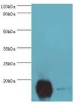 CPLX2 / Complexin 2 Antibody - Western blot. All lanes: Complexin-2 antibody at 6 ug/ml. Lane 1: rat brain tissue. Lane 2: A549 whole cell lysate. Secondary antibody: Goat polyclonal to rabbit at 1:10000 dilution. Predicted band size: 15 kDa. Observed band size: 15 kDa.