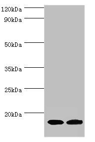 CPLX2 / Complexin 2 Antibody - Western blot All lanes: Complexin-2 antibody at 6µg/ml Lane 1: Rat brain tissue Lane 2: A549 whole cell lysate Secondary Goat polyclonal to rabbit IgG at 1/10000 dilution Predicted band size: 15 kDa Observed band size: 15 kDa