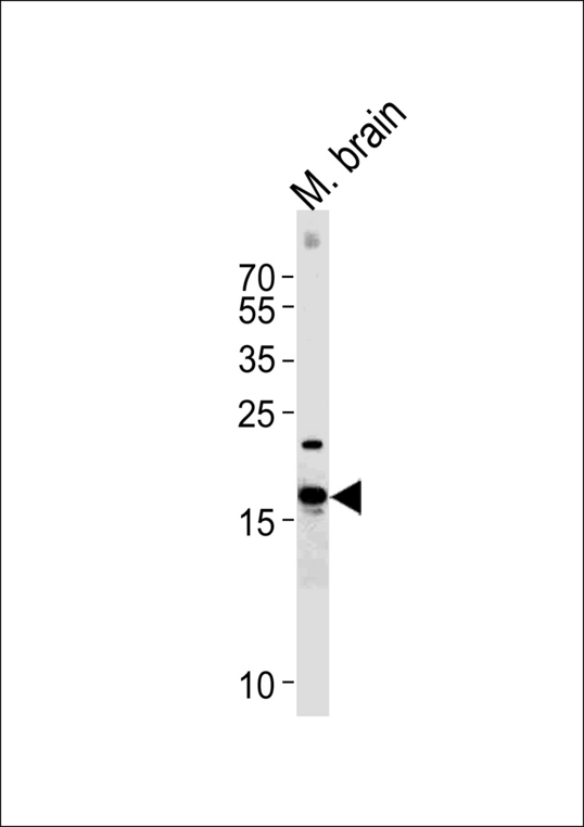 CPLX2 / Complexin 2 Antibody - Western blot of lysate from mouse brain tissue with CPLX2 Antibody. Antibody was diluted at 1:1000. A goat anti-rabbit IgG H&L (HRP) at 1:5000 dilution was used as the secondary antibody. Lysate at 35 ug.