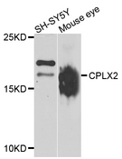 CPLX2 / Complexin 2 Antibody - Western blot analysis of extracts of various cell lines.