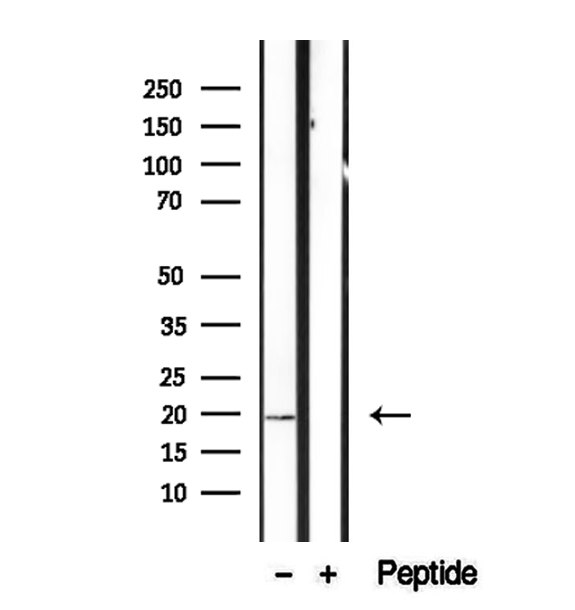 CPLX2 / Complexin 2 Antibody - Western blot analysis of extracts of mouse brain tissue using CPLX2 antibody.