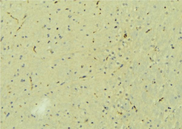 CPLX2 / Complexin 2 Antibody - 1:100 staining mouse brain tissue by IHC-P. The sample was formaldehyde fixed and a heat mediated antigen retrieval step in citrate buffer was performed. The sample was then blocked and incubated with the antibody for 1.5 hours at 22°C. An HRP conjugated goat anti-rabbit antibody was used as the secondary.