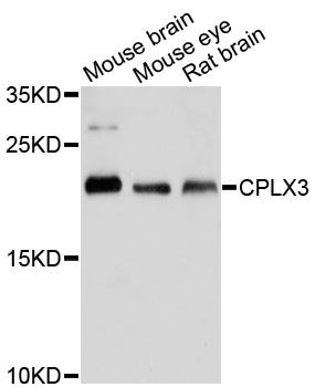 CPLX3 Antibody - Western blot analysis of extracts of various cell lines, using CPLX3 antibody at 1:3000 dilution. The secondary antibody used was an HRP Goat Anti-Rabbit IgG (H+L) at 1:10000 dilution. Lysates were loaded 25ug per lane and 3% nonfat dry milk in TBST was used for blocking. An ECL Kit was used for detection and the exposure time was 90s.