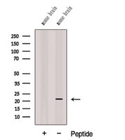 CPLX3 Antibody - Western blot analysis of extracts of mouse brain tissue using CPLX3 antibody. The lane on the left was treated with blocking peptide.