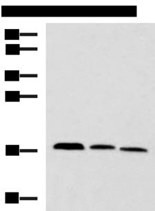 CPLX3 Antibody - Western blot analysis of Mouse kidney tissue Rat brain tissue Mouse liver tissue lysates  using CPLX3 Polyclonal Antibody at dilution of 1:950