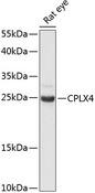 CPLX4 / Complexin IV Antibody - Western blot analysis of extracts of rat eye using CPLX4 Polyclonal Antibody at dilution of 1:3000.