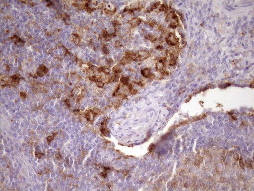 CPM / Carboxypeptidase M Antibody - IHC of paraffin-embedded Human lymph node tissue using anti-CPM mouse monoclonal antibody. (Heat-induced epitope retrieval by Tris-EDTA, pH8.0)(1:150).