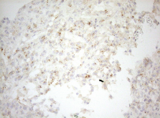 CPM / Carboxypeptidase M Antibody - Immunohistochemical staining of paraffin-embedded Human liver tissue within the normal limits using anti-CPM mouse monoclonal antibody. (Heat-induced epitope retrieval by 1mM EDTA in 10mM Tris buffer. (pH8.5) at 120°C for 3 min. (1:150)