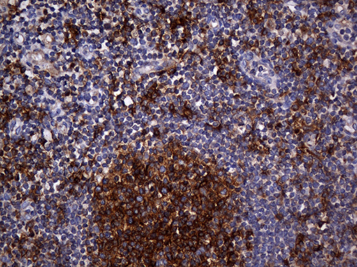 CPM / Carboxypeptidase M Antibody - Immunohistochemical staining of paraffin-embedded Human tonsil within the normal limits using anti-CPM mouse monoclonal antibody. (Heat-induced epitope retrieval by 1mM EDTA in 10mM Tris buffer. (pH8.5) at 120°C for 3 min. (1:2000)