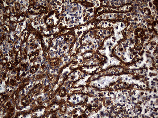 CPM / Carboxypeptidase M Antibody - Immunohistochemical staining of paraffin-embedded Human spleen tissue within the normal limits using anti-CPM mouse monoclonal antibody. (Heat-induced epitope retrieval by 1mM EDTA in 10mM Tris buffer. (pH8.5) at 120°C for 3 min. (1:2000)