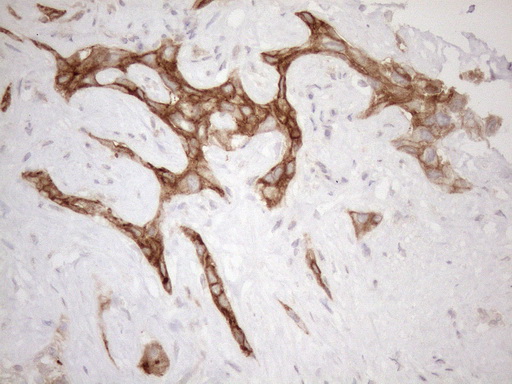 CPM / Carboxypeptidase M Antibody - Immunohistochemical staining of paraffin-embedded Human liver tissue within the normal limits using anti-CPM mouse monoclonal antibody. (Heat-induced epitope retrieval by 1mM EDTA in 10mM Tris buffer. (pH8.5) at 120 oC for 3 min. (1:150)