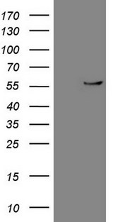 CPM / Carboxypeptidase M Antibody - HEK293T cells were transfected with the pCMV6-ENTRY control. (Left lane) or pCMV6-ENTRY CPM. (Right lane) cDNA for 48 hrs and lysed. Equivalent amounts of cell lysates. (5 ug per lane) were separated by SDS-PAGE and immunoblotted with anti-CPM. (1:500)