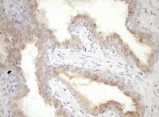 CPM / Carboxypeptidase M Antibody - Immunohistochemical staining of paraffin-embedded Human prostate tissue within the normal limits using anti-CPM mouse monoclonal antibody. (Heat-induced epitope retrieval by Tris-EDTA, pH8.0)(1:150)