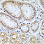CPM / Carboxypeptidase M Antibody - Immunohistochemistry of paraffin-embedded human stomach tissue.