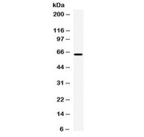 CPM / Carboxypeptidase M Antibody - Western blot testing of human HepG2 cell lysate with Carboxypeptidase M antibody at 0.5ug/ml. Predicted molecular weight ~51 kDa but routinely observed at 58-65 kDa due to glycosylation.