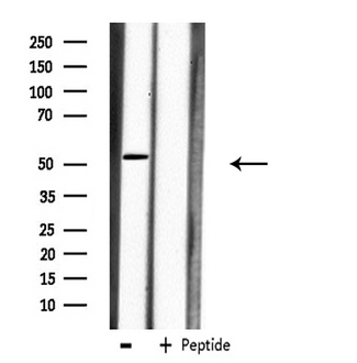CPM / Carboxypeptidase M Antibody - Western blot analysis of extracts of A549 cells using CPM antibody.
