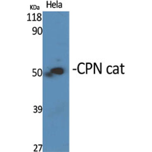CPN1 Antibody - Western blot of CPN cat antibody