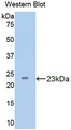 CPN1 Antibody - Western Blot; Sample: Recombinant protein.
