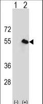CPN1 Antibody - Western blot of CPN1 (arrow) using rabbit polyclonal CPN1 Antibody. 293 cell lysates (2 ug/lane) either nontransfected (Lane 1) or transiently transfected (Lane 2) with the CPN1 gene.