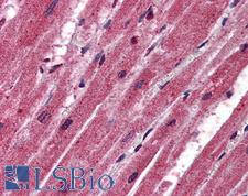 CPN1 Antibody - Anti-CPN1 antibody IHC of human heart. Immunohistochemistry of formalin-fixed, paraffin-embedded tissue after heat-induced antigen retrieval. Antibody concentration 2.5 ug/ml.  This image was taken for the unconjugated form of this product. Other forms have not been tested.