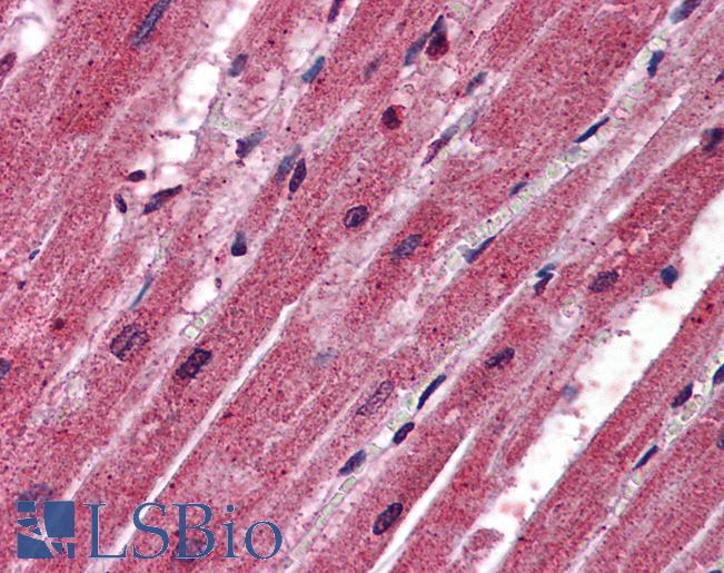 CPN1 Antibody - Anti-CPN1 antibody IHC of human heart. Immunohistochemistry of formalin-fixed, paraffin-embedded tissue after heat-induced antigen retrieval. Antibody concentration 2.5 ug/ml.  This image was taken for the unconjugated form of this product. Other forms have not been tested.