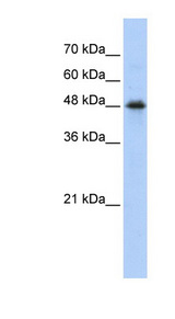 CPN1 Antibody - CPN1 antibody Western blot of Transfected 293T cell lysate. This image was taken for the unconjugated form of this product. Other forms have not been tested.