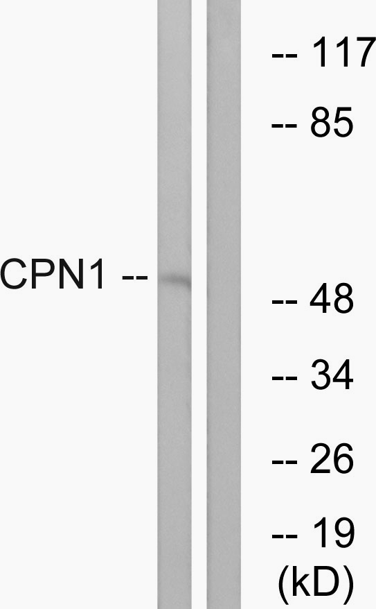 CPN1 Antibody - Western blot analysis of lysates from RAW264.7 cells, using CPN1 Antibody. The lane on the right is blocked with the synthesized peptide.
