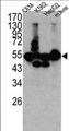 CPN1 Antibody - Western blot of CPN1 antibody in K562, CEM, HEpG2 cell line lysates and mouse liver tissue lysates (35 ug/lane). CPN1(arrow) was detected using the purified antibody.