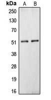 CPN1 Antibody - Western blot analysis of Carboxypeptidase N 1 expression in HepG2 (A); HEK293T (B) whole cell lysates.
