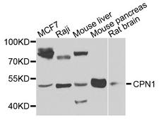 CPN1 Antibody - Western blot analysis of extracts of various cells.