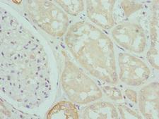 CPN1 Antibody - Immunohistochemistry of paraffin-embedded human kidney tissue at dilution 1:100