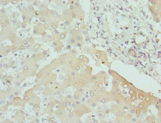 CPN1 Antibody - Immunohistochemistry of paraffin-embedded human liver tissue at dilution 1:100