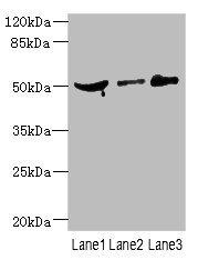 CPN1 Antibody - Western blot All Lanes: CPN1 antibody at 6.19ug/ml Lane 1: Mouse liver tissue Lane 2: MCF7 whole cell lysate Lane 3: HepG-2 whole cell lysate Goat polyclonal to Rabbit IgG at 1/10000 dilution Predicted band size: 52 kDa Observed band size: 52 kDa