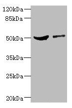 CPN1 Antibody - Western blot All lanes: CPN1 antibody at 6.19µg/ml Lane 1: Mouse liver tissue Lane 2: MCF-7 whole cell lysate Secondary Goat polyclonal to rabbit IgG at 1/10000 dilution Predicted band size: 52 kDa Observed band size: 52 kDa