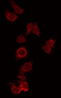 CPN1 Antibody - Staining RAW264.7 cells by IF/ICC. The samples were fixed with PFA and permeabilized in 0.1% Triton X-100, then blocked in 10% serum for 45 min at 25°C. The primary antibody was diluted at 1:200 and incubated with the sample for 1 hour at 37°C. An Alexa Fluor 594 conjugated goat anti-rabbit IgG (H+L) Ab, diluted at 1/600, was used as the secondary antibody.