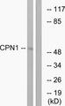 CPN1 Antibody - Western blot analysis of extracts from RAW264.7 cells, using CPN1 antibody.