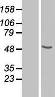 CPN1 Protein - Western validation with an anti-DDK antibody * L: Control HEK293 lysate R: Over-expression lysate