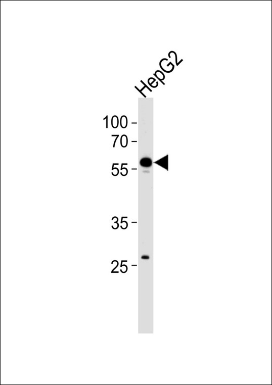 CPN2 Antibody - Western blot of lysate from HepG2 cell line, using CPN2 Antibody. Antibody was diluted at 1:1000 at each lane. A goat anti-rabbit IgG H&L (HRP) at 1:5000 dilution was used as the secondary antibody. Lysate at 35ug per lane.