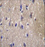 CPN2 Antibody - CPN2 Antibody immunohistochemistry of formalin-fixed and paraffin-embedded human brain tissue followed by peroxidase-conjugated secondary antibody and DAB staining.