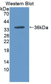 CPN2 Antibody - Western blot of CPN2 antibody.