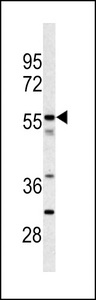 CPN2 Antibody - Western blot of CPN2 antibody in Jurkat cell line lysates (35 ug/lane). CPN2 (arrow) was detected using the purified antibody.