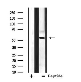 CPN2 Antibody - Western blot analysis of extracts of HeLa cells using CPN2 antibody.