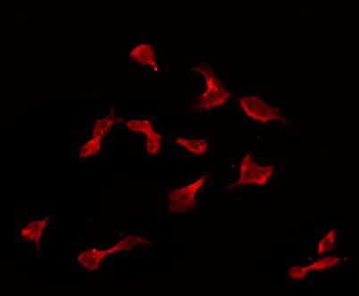 CPN2 Antibody - Staining HeLa cells by IF/ICC. The samples were fixed with PFA and permeabilized in 0.1% Triton X-100, then blocked in 10% serum for 45 min at 25°C. The primary antibody was diluted at 1:200 and incubated with the sample for 1 hour at 37°C. An Alexa Fluor 594 conjugated goat anti-rabbit IgG (H+L) Ab, diluted at 1/600, was used as the secondary antibody.