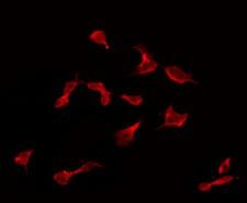 CPN2 Antibody - Staining HeLa cells by IF/ICC. The samples were fixed with PFA and permeabilized in 0.1% Triton X-100, then blocked in 10% serum for 45 min at 25°C. The primary antibody was diluted at 1:200 and incubated with the sample for 1 hour at 37°C. An Alexa Fluor 594 conjugated goat anti-rabbit IgG (H+L) Ab, diluted at 1/600, was used as the secondary antibody.