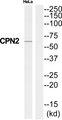 CPN2 Antibody - Western blot analysis of extracts from HeLa cells, using CPN2 antibody.