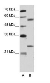 CPNE1 / Copine I Antibody - A: Marker, B: HepG2 Cell Lysate.  This image was taken for the unconjugated form of this product. Other forms have not been tested.