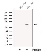 CPNE1 / Copine I Antibody - Western blot analysis of extracts of HEK293T cells using CPNE1 antibody. The lane on the left was treated with blocking peptide.